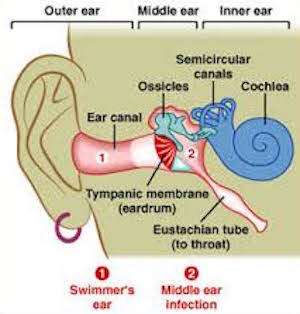 What is swimmers ear