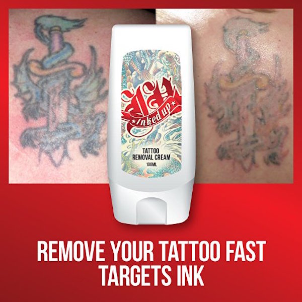 Top 6 Best Tattoo Removal Creams Reviewed in 2018