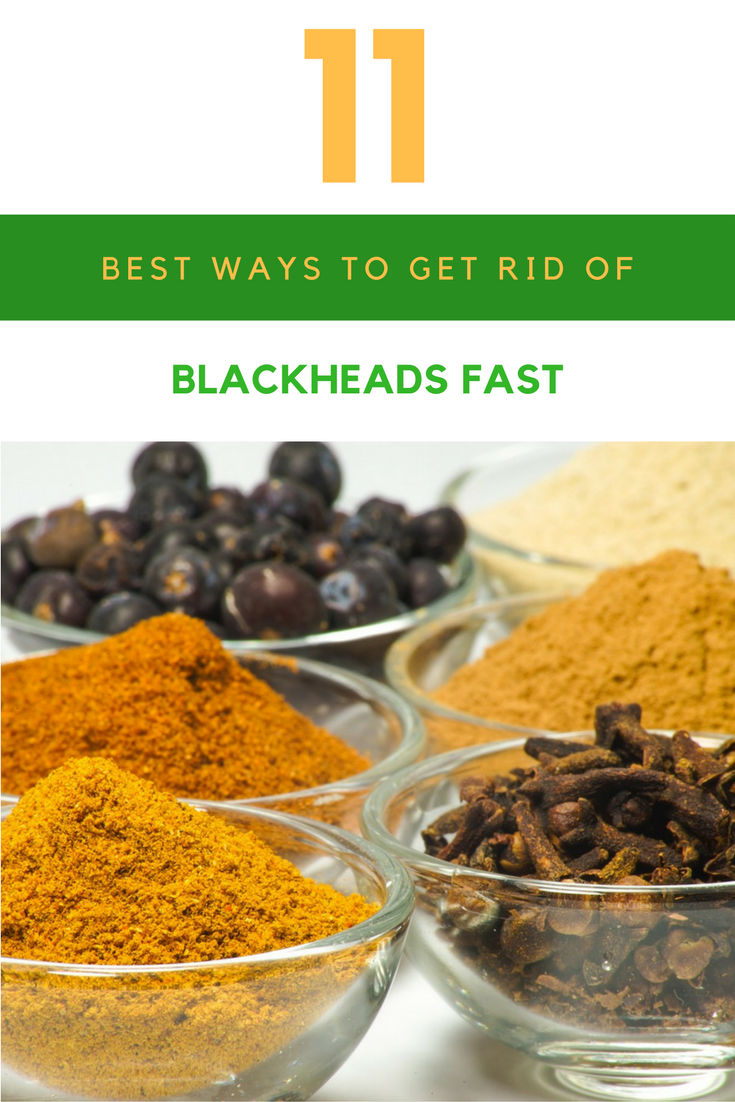 11 Best Ways to Get Rid of Blackheads Fast. | Ideahacks.com
