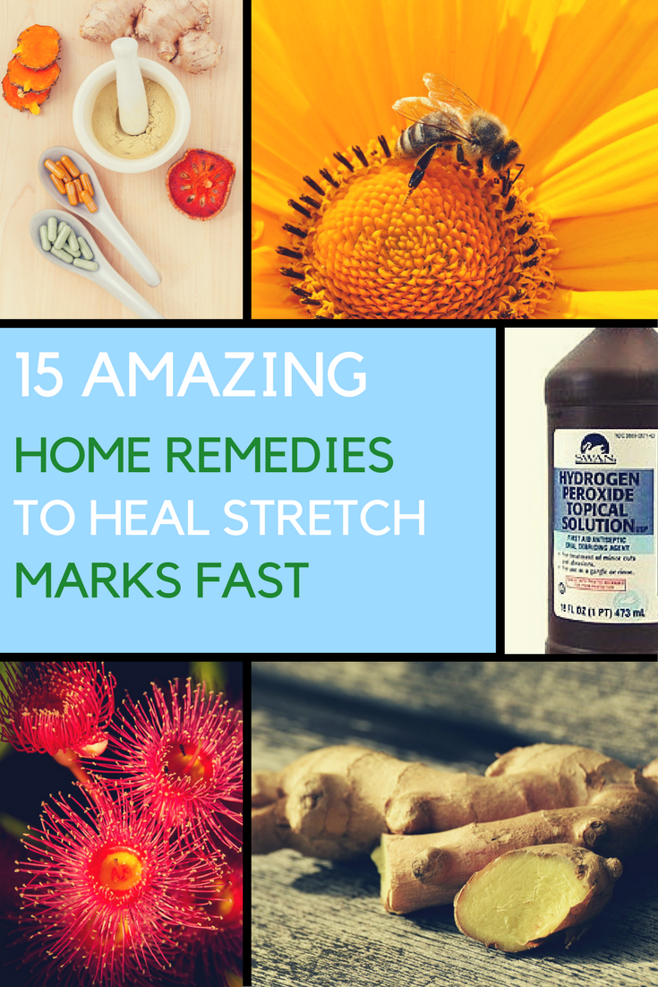 10 Powerful Natural Remedies for Allergy Relief. | Ideahacks.com