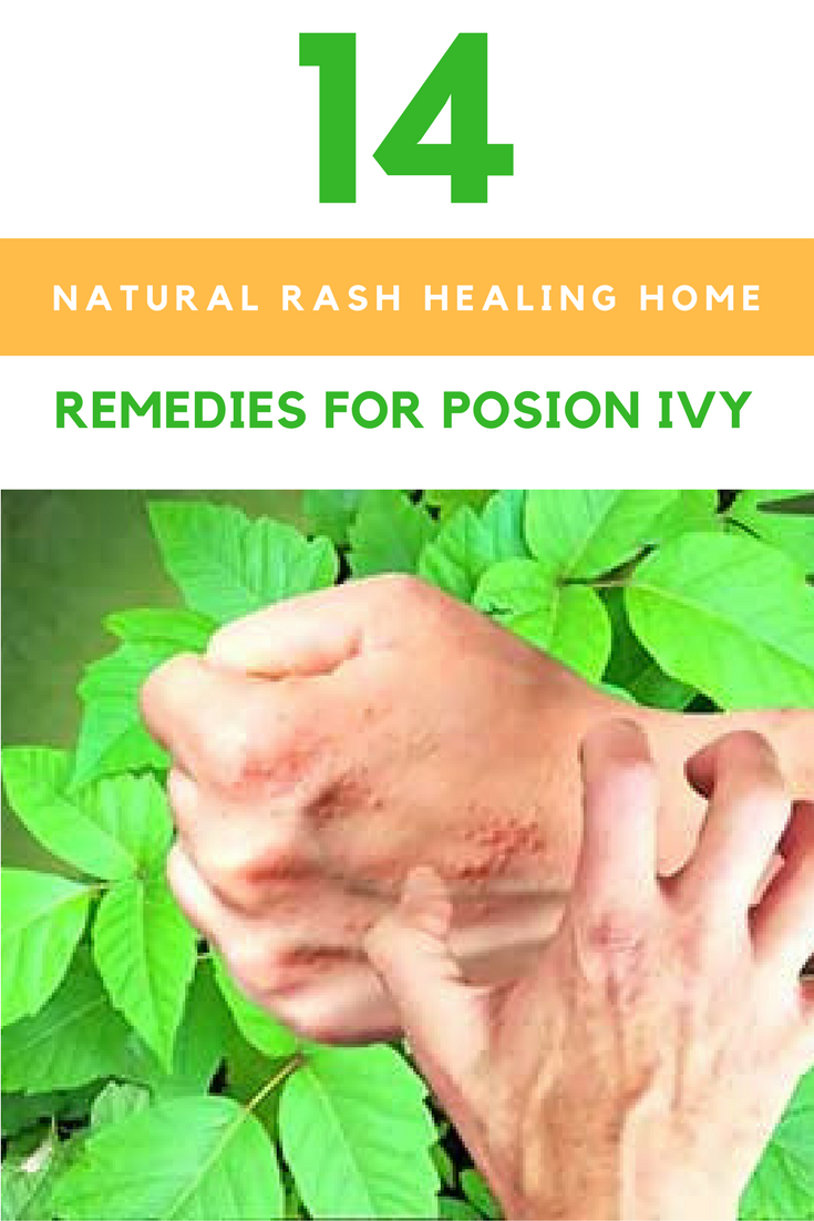 14 Natural Rash Healing Home Remedies For Poison Ivy. | Ideahacks.com