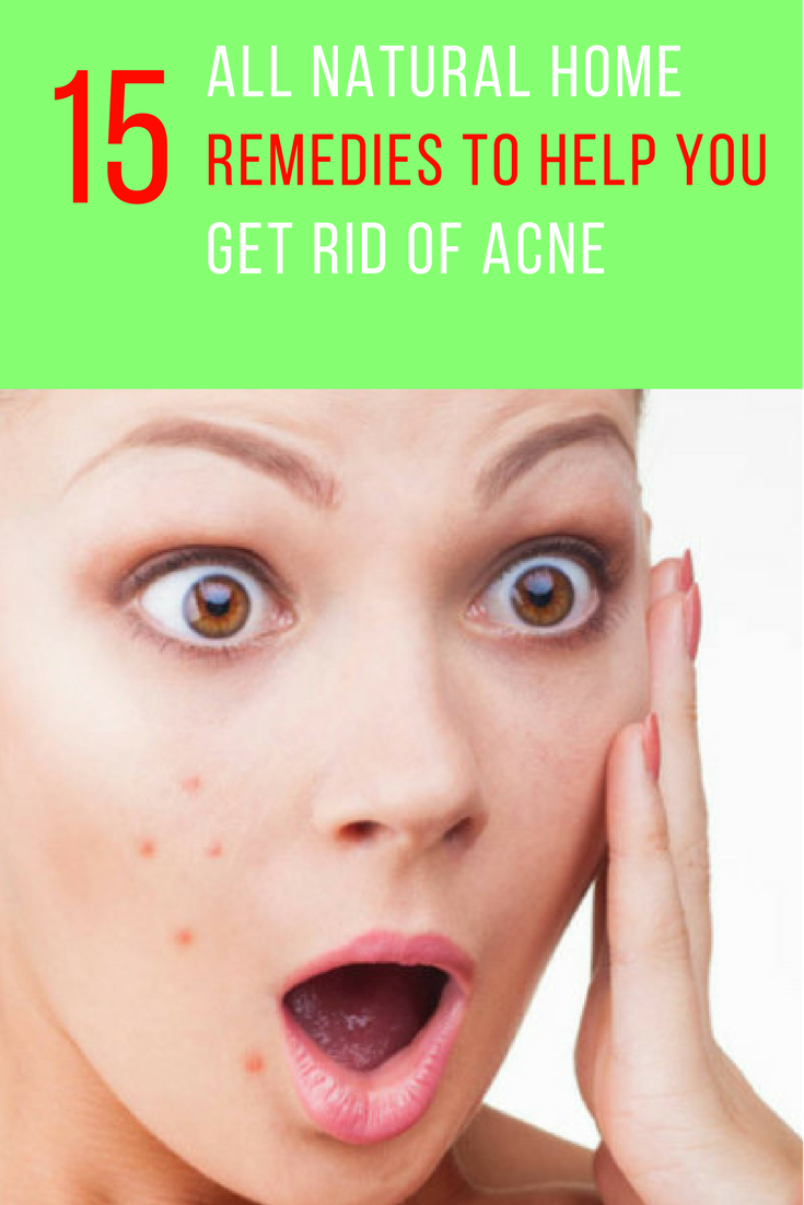 15 All Natural Home Remedies To Help Get Rid Of Acne. | Ideahacks.com