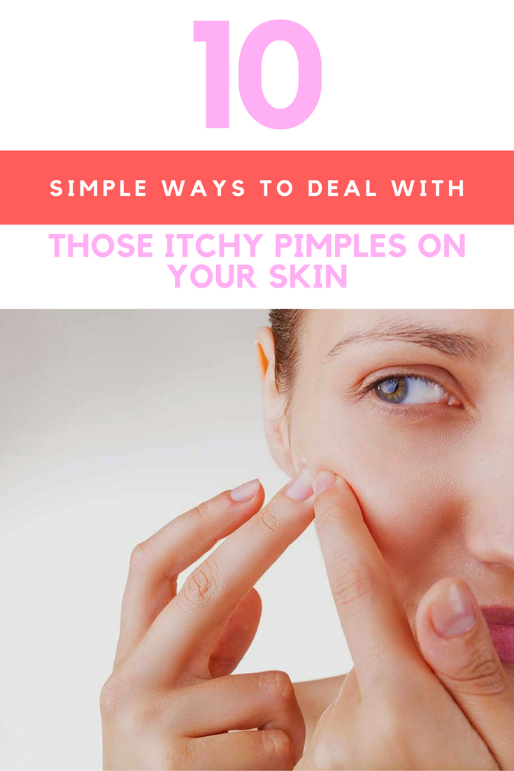 Do You Have Itchy Pimples on Your Skin? Here Are 10 Ways To Deal With The Itching. | Ideahacks.com