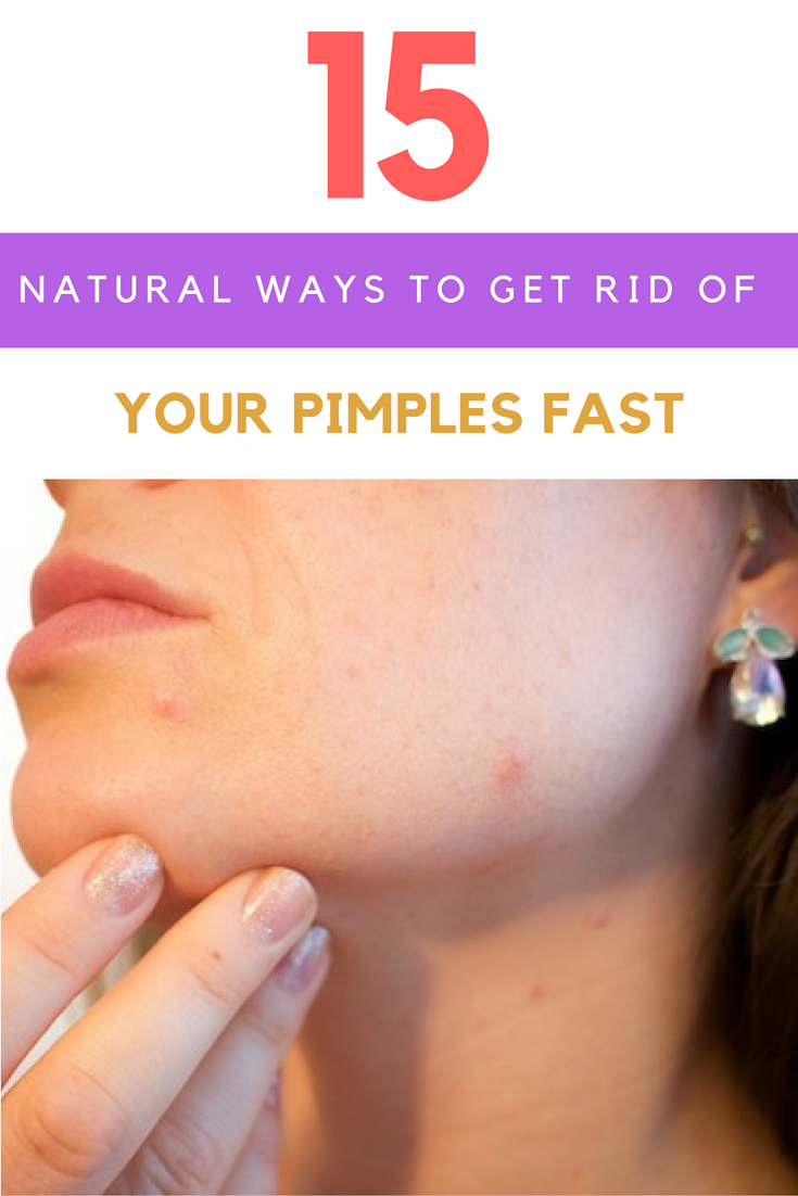 Natural Ways to Get Rid of Your Pimples Fast