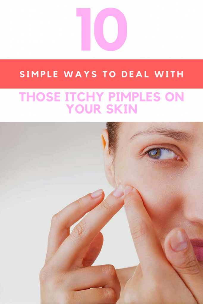 Itchy Pimples on Your Skin? Here's 10 Ways to Deal with Them