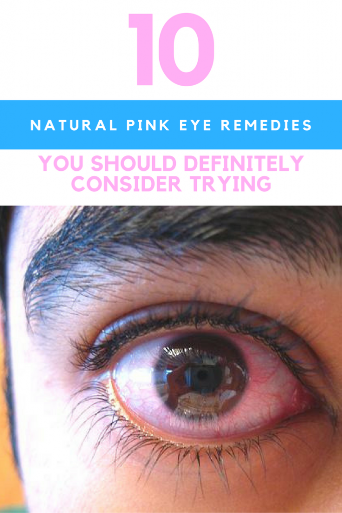 10 Natural Pink Eye Remedies That Really Work